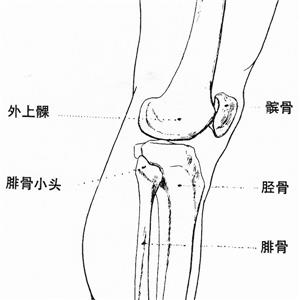 右股骨髁間粉碎性骨折、左髕骨粉碎性骨折被鑒定為七級(jí)工傷