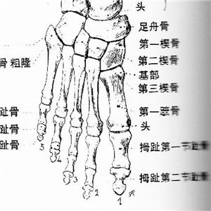 右足第5跖骨基底部骨折被鑒定為十級(jí)工傷