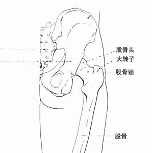 左股骨頸骨折內(nèi)固定術(shù)被鑒定為九級(jí)工傷